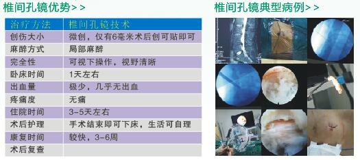 QQ截图20170913161433